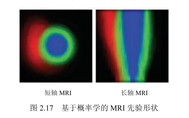 原书图2.17：基于概率学的 MRI 先验形状